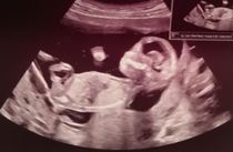 Do you want me to guess the sex? 12 week scans.