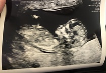Gender Guess!