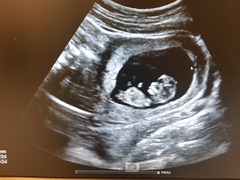 Gender guesses for my 12 week scan please
