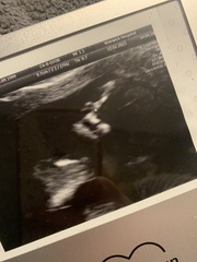 Do you want me to guess the sex? 12 week scans.