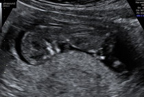 Do you want me to guess the sex? 12 week scans.
