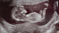 Due September - Any gender guesses?