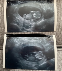 September 2021 thread 3 🥳