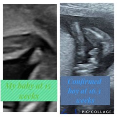 15 week scan images...