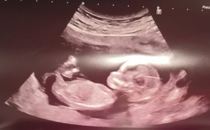 Do you want me to guess the sex? 12 week scans.