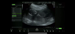 Do you want me to guess the sex? 12 week scans.