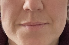 Best cleanser for rosacea sufferer