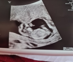 Do you want me to guess the sex? 12 week scans.