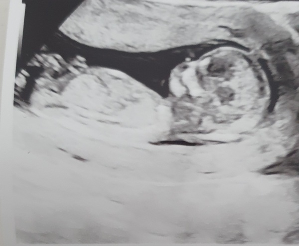 This is a boy isnt it? Any specialists around?