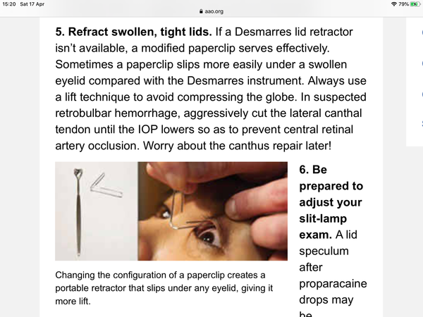 Toddler wore my glasses and now I am worried