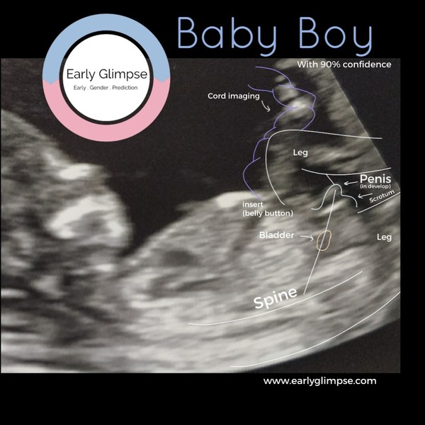 Gender Guesses 13+4