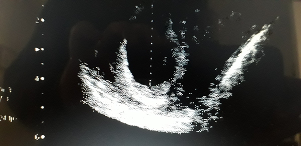 Scan photo - confusion