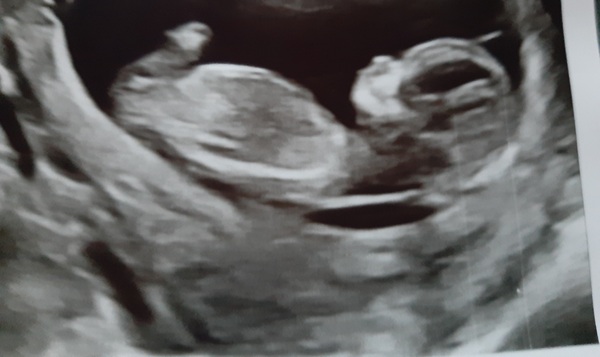 Do you want me to guess the sex? 12 week scans.