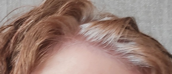 Should I embrace white hair at 47?
