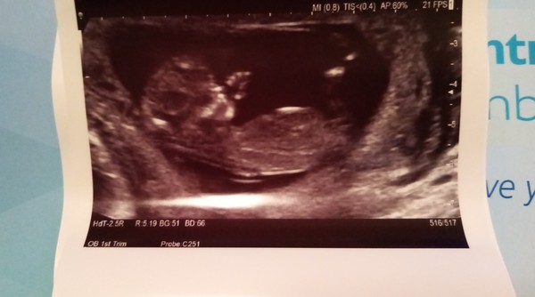 13 weeks confused?