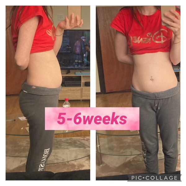 Baby bump 6+ weeks