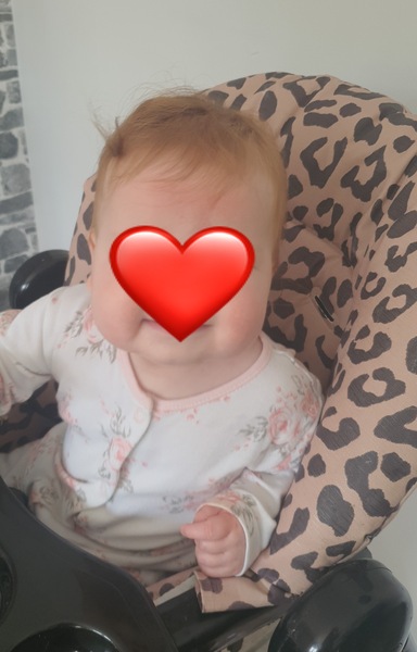 Baby has red forehead??