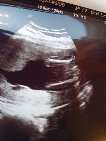 Another gender guess!!