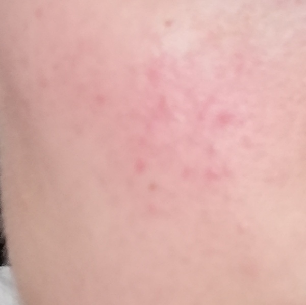 Does anyone know what these little red spots are?