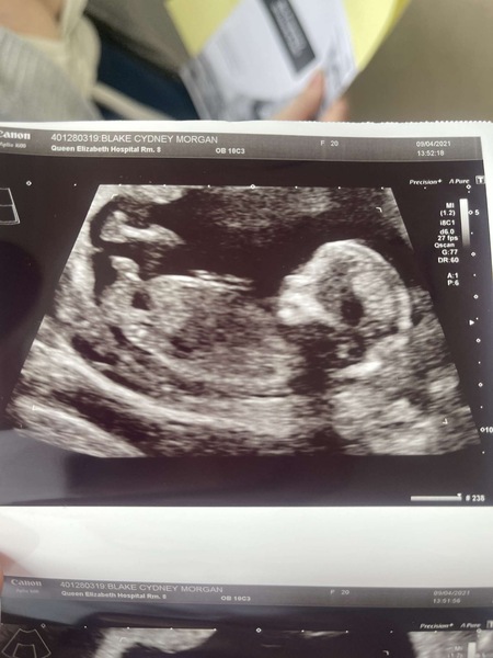 13 week gender guess!