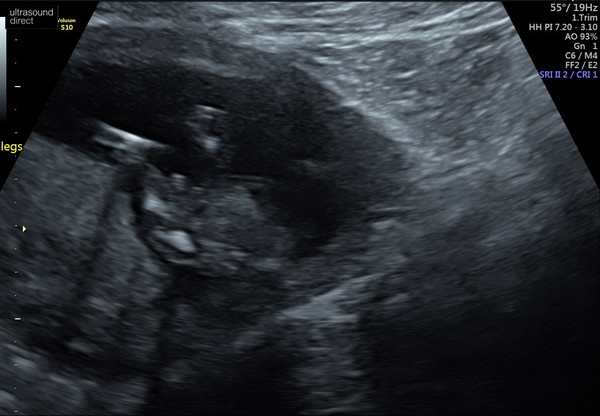 This is definitely a boy right?