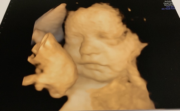 3d/4d scan reviews!