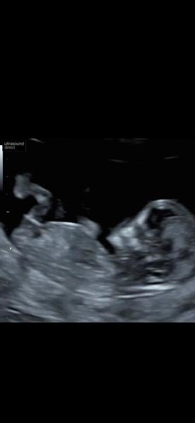 Gender Guess!