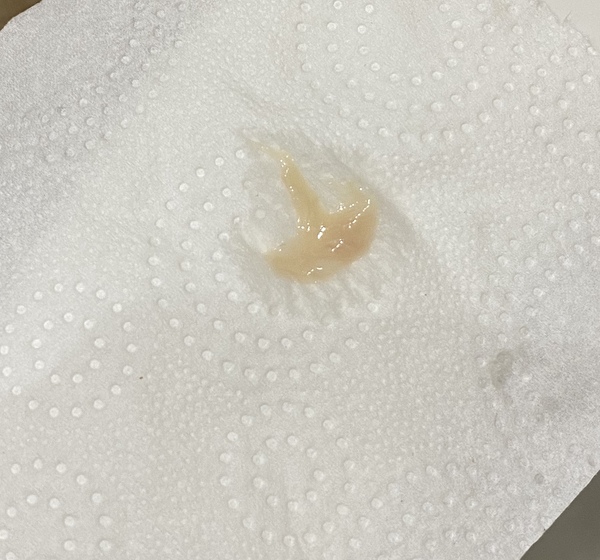 TMI Photo - is this my mucus plug?