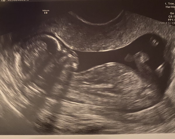 Gender guess