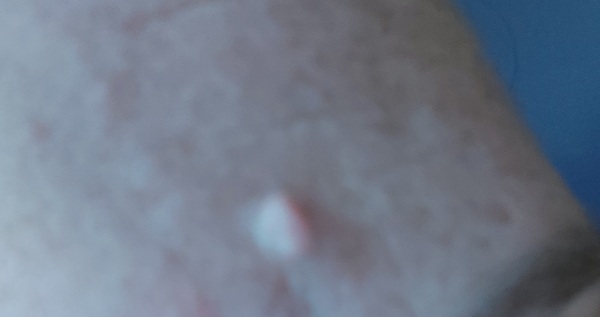 What is it and can I get rid?