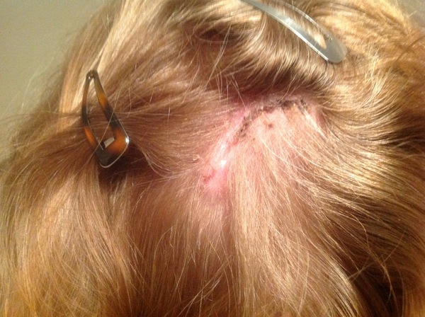 The best thing your body has produced *warning-grim content not suitable for weak-stomached persons*