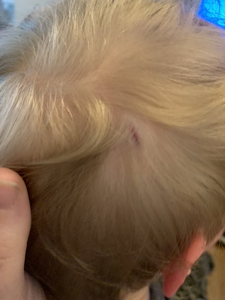 Bump to the head
