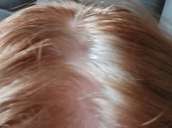 Should I embrace white hair at 47?