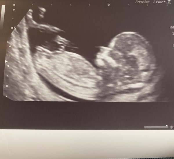 Gender Guesses