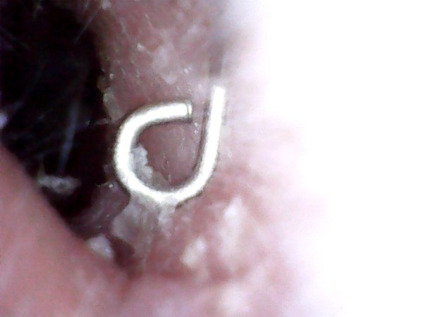 The best thing your body has produced *warning-grim content not suitable for weak-stomached persons*