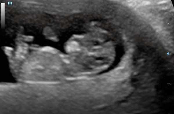 October 2021 - part 2
