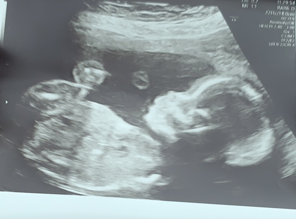 Aug 2021 - 2nd Trimester continues