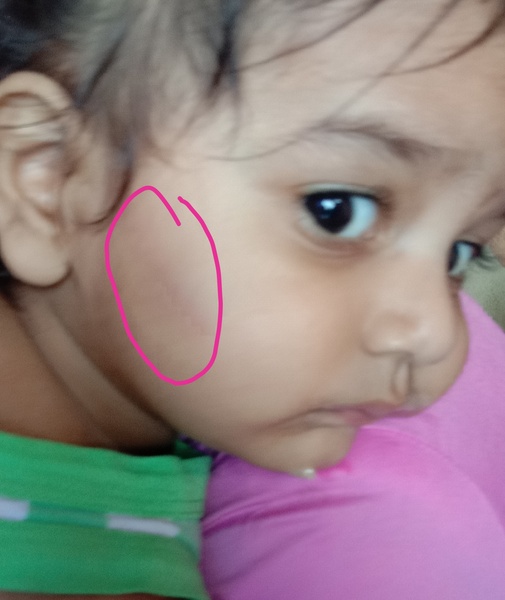 My 14 months old DS hit his head sideways on edge of bed. Hes
