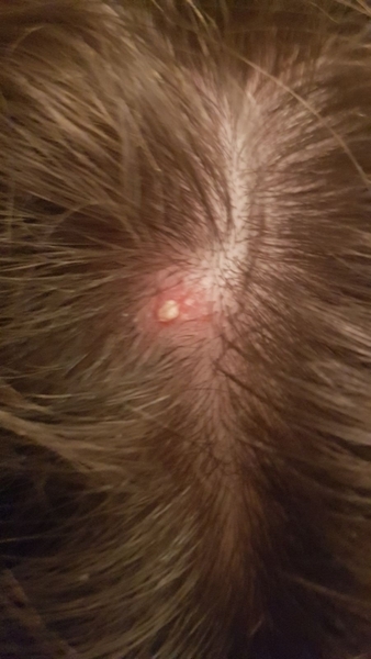 The best thing your body has produced *warning-grim content not suitable for weak-stomached persons*