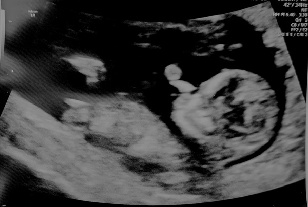 October 2021 - part 2