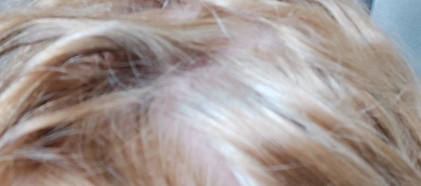 Should I embrace white hair at 47?