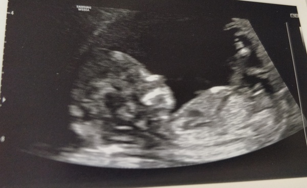 Do you want me to guess the sex? 12 week scans.