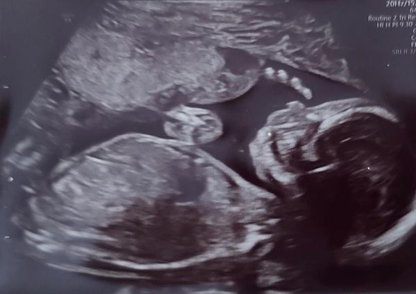 Aug 2021 - 2nd Trimester continues