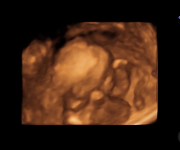 September 2021 - Thread 4