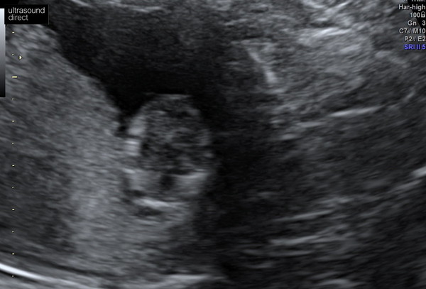 Scan photo - confusion