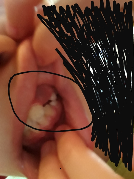 Any dentists/hygienists please?
