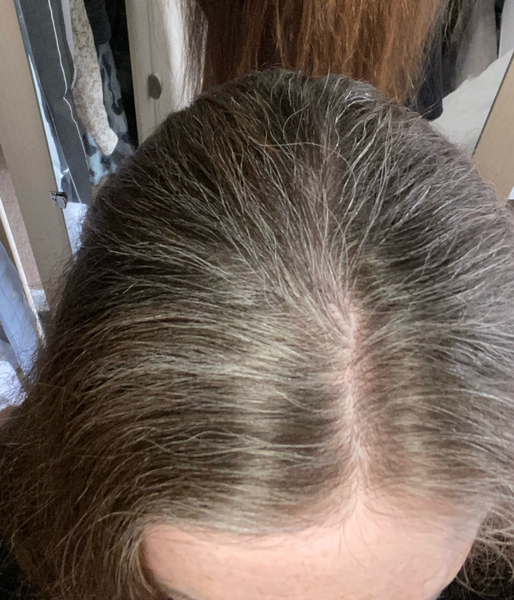 Hair Dilemma - need help (with pics)