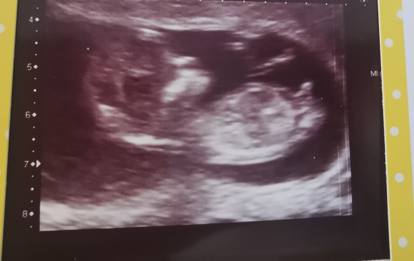 Gender Guess!
