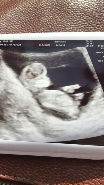 Anxious- 11 weeks