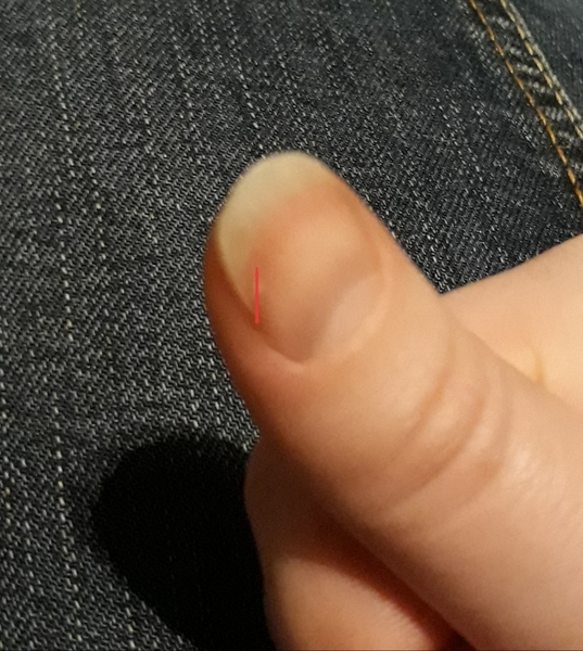 Help! Broken nail